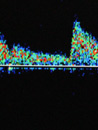 Neurologie am Lietzensee EEG, EMG, Doppler