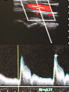 Neurologie am Lietzensee EEG, EMG, Doppler